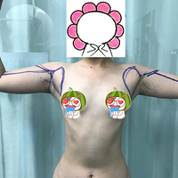 ������֬���������