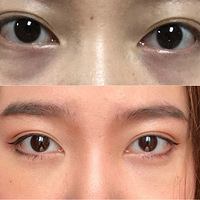 ���������������˿����ͷ�ȥ�۴�����