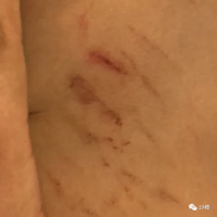 ������У�ſڼ������ҳ�Ⱥ�����ְ�Լ�ܴ��ͷ��Ѫ��������ȴ��