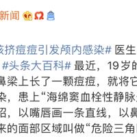 ICU���棺�㼷���������ӣ�������������