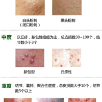 �����ˣ��������������Ķ��ܲ��ˣ�