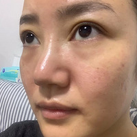 �������ο������꼪��fotona4d���о�����ȥ���۴�������