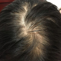 ӵ�ж�����Ѿ����ͺͷ��Ůǰ���㱨���飡����ͷ������������