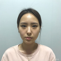 ����view������ĥ����������ӷ���Ҳ��ԳƵ��������