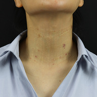 ������ע�����������֮��Ч��ȷʵ����