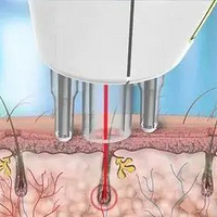 ���Ŷ���Ͻ�ȥ����Щҽ����Ŀ�����ı�����