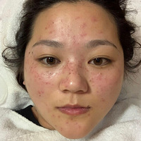 ��Ƥ����ߣ��������̫��