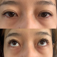 ��ҹ������ȥ���۴�������ʹ��ֵ