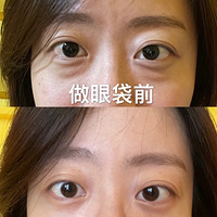 ���ڰ��۴�����