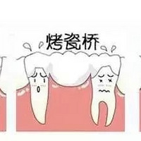 ��������̶���ݺ���ֲ�����׸���ôѡ��