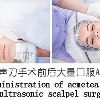 ���곬�����Ľ��ɶ�����𡢡��������ܡ��Զ������Ч����