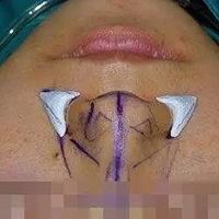 ��Ҫ��ǻ��ף��ȿ����ǻ���������Щ��Ļ��