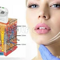 ����������Ч����ô���������ڿ����������������Ƿ�֪��~