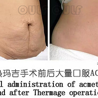 ���꼪�Ĵ�Ч����ô����ʲô�����꼪�Ĵ��Ĵ���