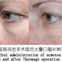 ������꼪�۸��Ƕ��٣�������꼪��ü�Ч��