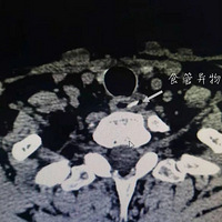 ����������̣��ȴס����׷�������ҽ��������ȷ����