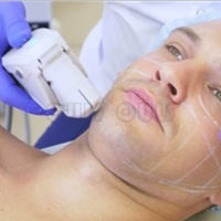 �ȵ��������꼪ʲôЧ�����𲻵�����~