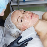 �Թ�Ŷ��ŷ��֮��fotona4dpro��ɶ���𱻺�����~