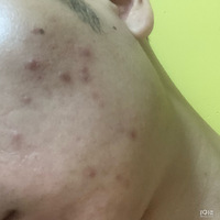 ������������ʽ�󱬷���ս������̫����