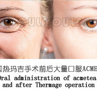 ���꼪Ч����ʵ�𣿲���ױҲ��������