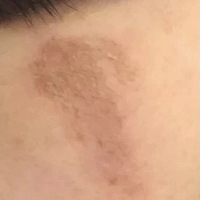 ����ü���ȥ��ɽ��û�뵽�����ֶ���ҧ�ˣ����ݹ��������