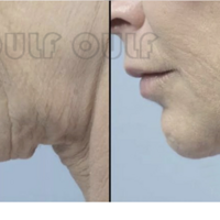 ���粨��Ƥ�������Ǯ�����Ѿ�����������~