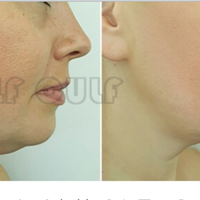 ŷ��֮��4d��һ�ζ���Ǯ�����ϸ�ȥ����~