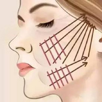 �ߵ��ÿ��ԺȾ��ߵ�ע����������Щ~