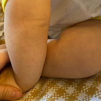 ���������������ղ��ˣ�����̿���ʽӦ�ԣ���ݾ����ܽ�ֵ�òο�