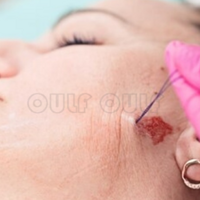 �Դӿ����ߵ���Ƶȫ��������������֪���沿�ߵ�Ի�����Ӱ����