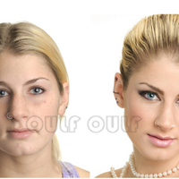 �ų��벻���ĳ�����Ƥզ����̹�׾�˵�沿��Ƥ�������Ա��ֶ�ã�