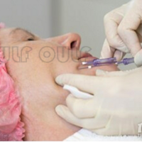 ���������ߵ�������ô���������������ߵ�������ȫ�ָ���