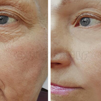 ��Ƥȥ����Ҫ����Ǯ�����𣿸Ͻ�ȰȰ�ң������Ҹ������ˣ�