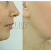 ��������ǰҪע��ʲô�������������������������Ϲ����