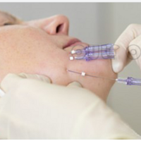 �����ߵ���Ӳ��İ��ѿ��Ĳ��У�������������ߵ�������ȫ�ָ�