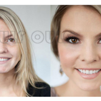 �������֬���������ײ��沿֬�����ָ��ռ������