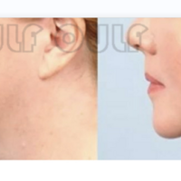 �������ݳ�����һ�ζ���Ǯ�����˻��Ǹ����ĳ�����Ч��զ����