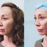 �����ߵ���Ƶȫ����������˵�ã�������ߵ�����һ�αȽϺã�