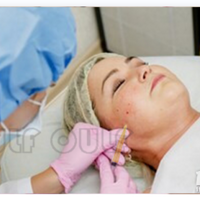 ���������沿֬�����ָ��ռǣ���֬����ûָ������֪���