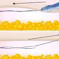 ȫ���ߵ���ʲôΣ�������������������и�������~