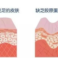 ͸�������沿�ߵ�ʮ����仯���ߵ��ûָ���Ȼ�ÿ���