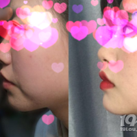 �沿�ߵ��۲��ۡ��沿�ߵ�����Ҫ�ۼ��졢�̲���~