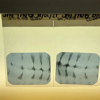 ���ݹ������ۿ�ҽ����һ�ž�Ҫ8ǧ��һ��ԭ������Щ�������ˢ��