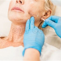 �沿�ߵ��۲��ۣ������沿�ߵ�һ��7��ͼƬ��