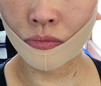 ���ߵ�᲻����ʲô����֢���ߵ����ͼ���ָ����÷���~