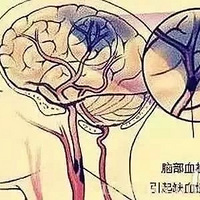 �붬��һ��Ҫ�ι��������