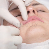 �����ߵ�3������Խ��Խ����ô�죬�ߵ�ȧ�Ǳ��ʲôʱ����Իָ�