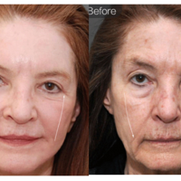 ������˵˵7d��������ʲô����֪��7d������Ч�����𣬿�������