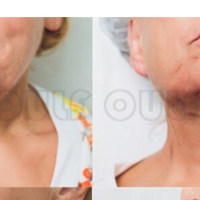 7d�����������������ٵģ��������ǰ�7d����������˥����