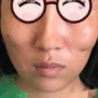 �������沿������û�и����á��沿�ߵ�����Σ��?ô?����������~